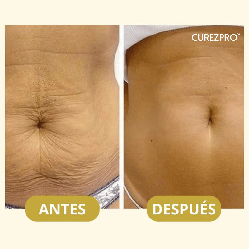 Aceite Corporal Magic™